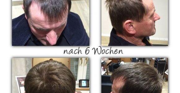 Kräftige Haare bekommen mit natürlicher Kopfhautpflege