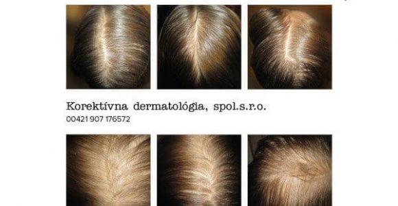 Mehr Volumen bei dünnen Haaren - Erfahrungsbericht