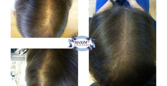 Beratung bei Haarausfall in Basel - Coiffure MAXIM's