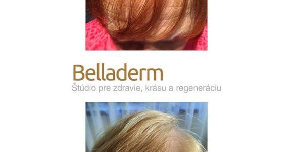 Vitaler Haarwuchs mit YELASAI - Erfahrungsbericht