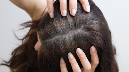 Graue Haare nach Chemotherapie: Ursachen, Pflege und Tipps image