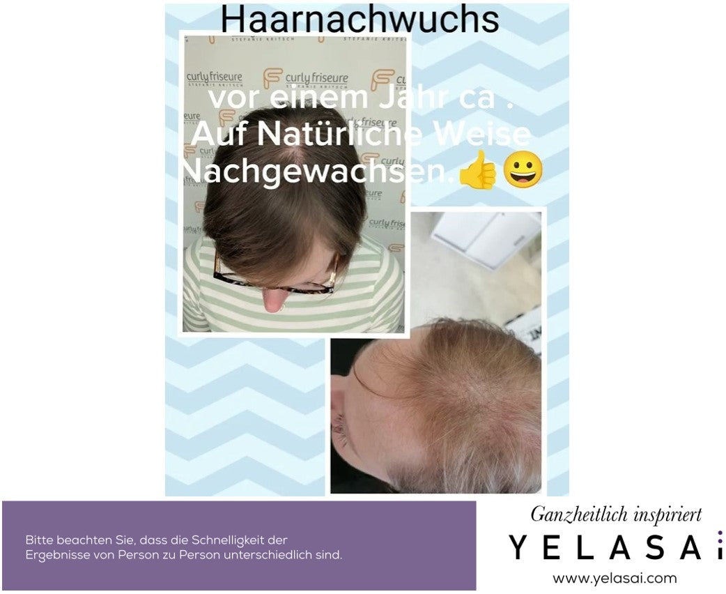 Haarverlust, dünnes und feines Haar, schlechter Haarwuchs bei der Frau