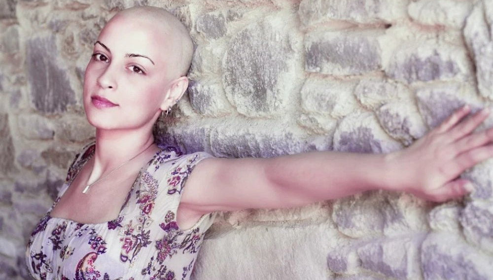 Frau mit Haarausfall nach Chemotherapie