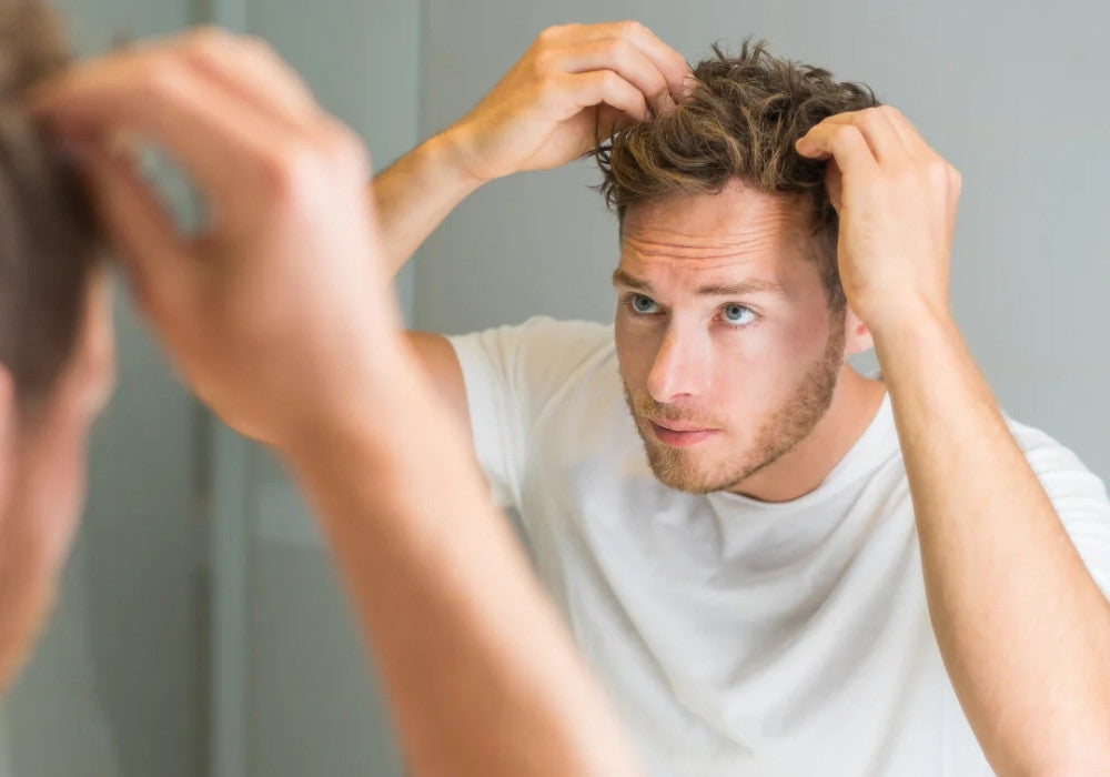 Mann ertastet Haare wegen Haarausfall bei Männern