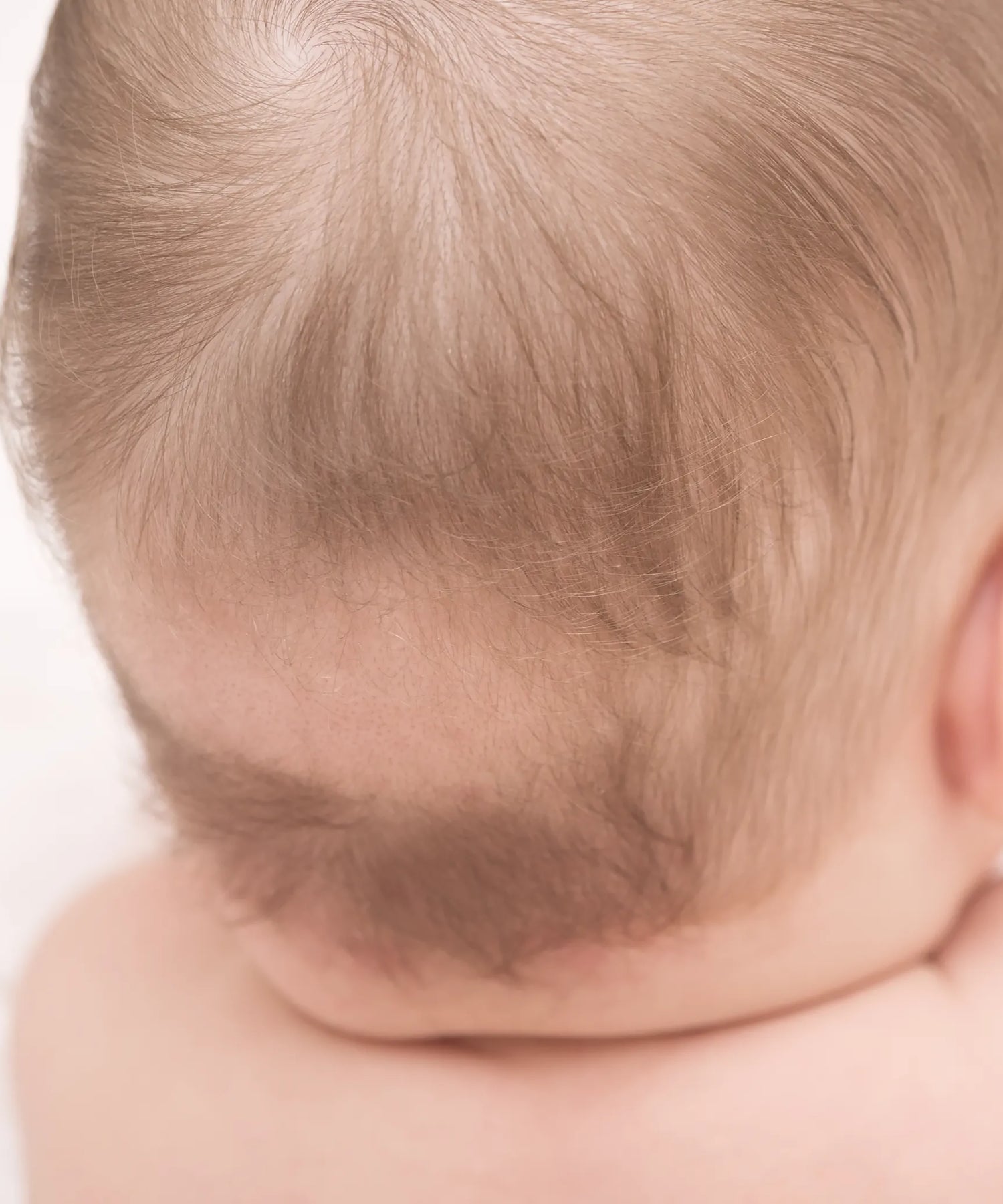 baby geheimratsecken hilfe für eltern bei haarausfall kind