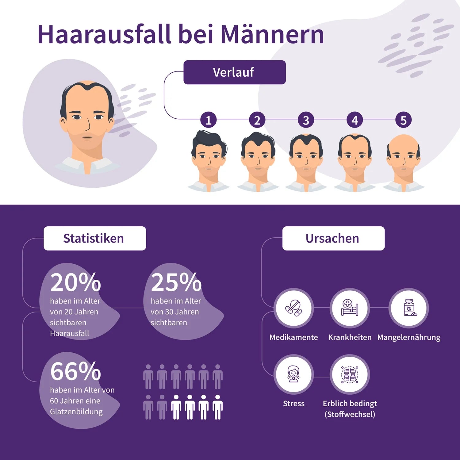 Infografik Haarausfall bei Männern
