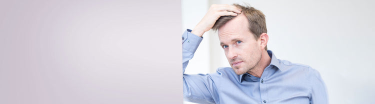 Haarausfall beim Mann Banner