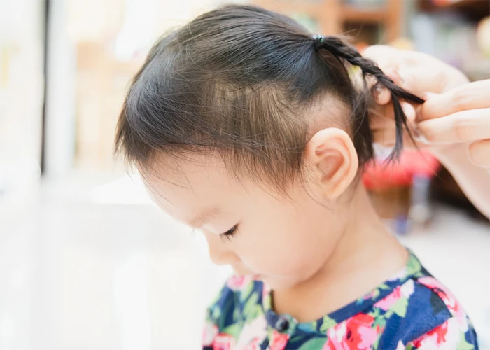 junges mädchen kind mit haarausfall leere stellen am kopf yelasai