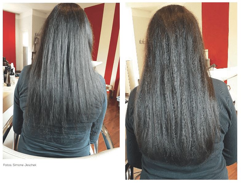 Haarausfall durch Stress sowie Neurodermitis und Rheuma