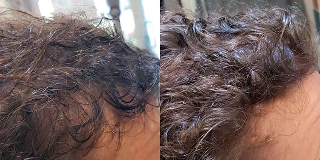 Erfahrung: stark fettige Haare oder schwitzige Kopfhaut