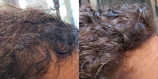 Expérience : cheveux très gras ou cuir chevelu qui transpire beaucoup