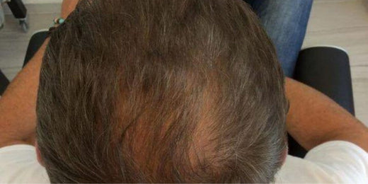 Expérience : cheveux clairsemés ou fatigués
