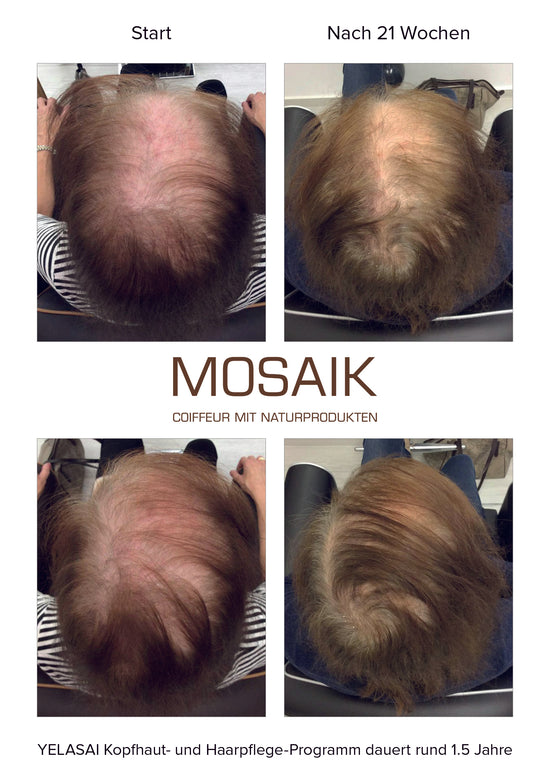 Referenzen von Haarwuchs-Spezialist Salon Mosaik - Chur