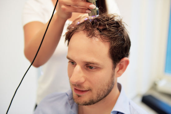 Haarausfall bei Männern stoppen mit natürlicher Pflege – geht das?