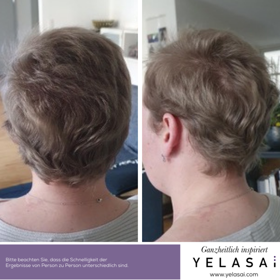 Haare wachsen während Chemo wieder