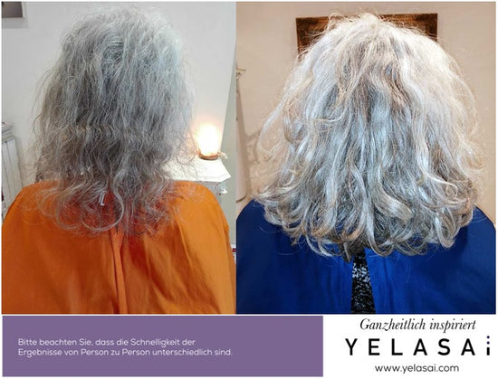 Haarverlust durch Virusinfektion - Pflege mit YELASAI