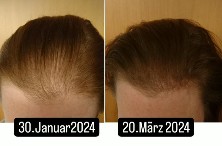 haarpflege bei stressbedingtem haarausfall yelasai
