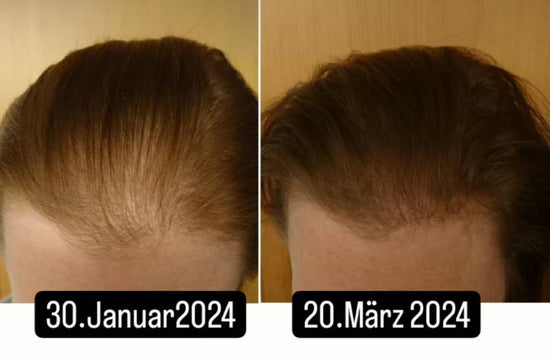 haarpflege bei stressbedingtem haarausfall yelasai