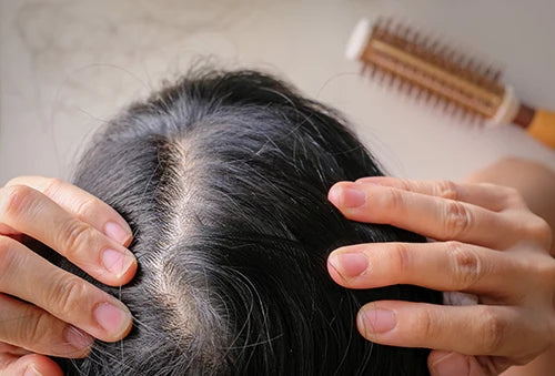 minoxidil frauen haare haarausfall natürliche haarpflege yelasai
