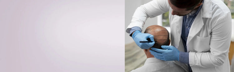Mann ist beim Arzt und hat keine Alternative zur Haartransplantation
