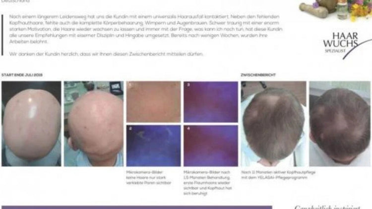 Erfahrungsbericht zu YELASAI