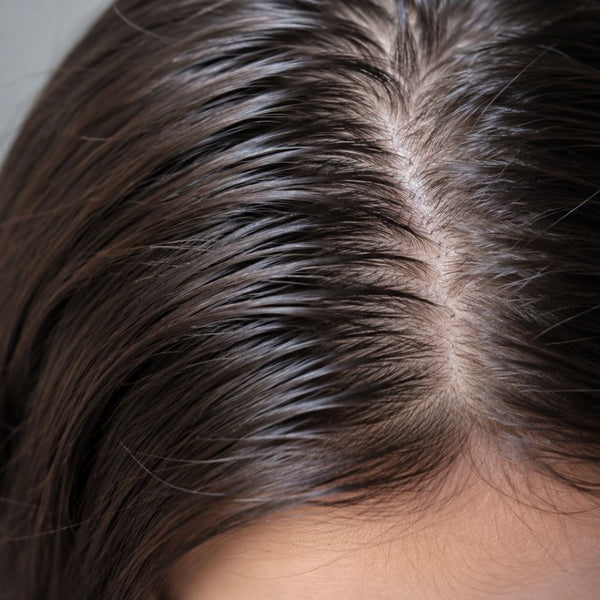 Kopfhautpeeling für fettiges Haar