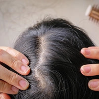 diffuser haarausfall ursachen symptome yelasai